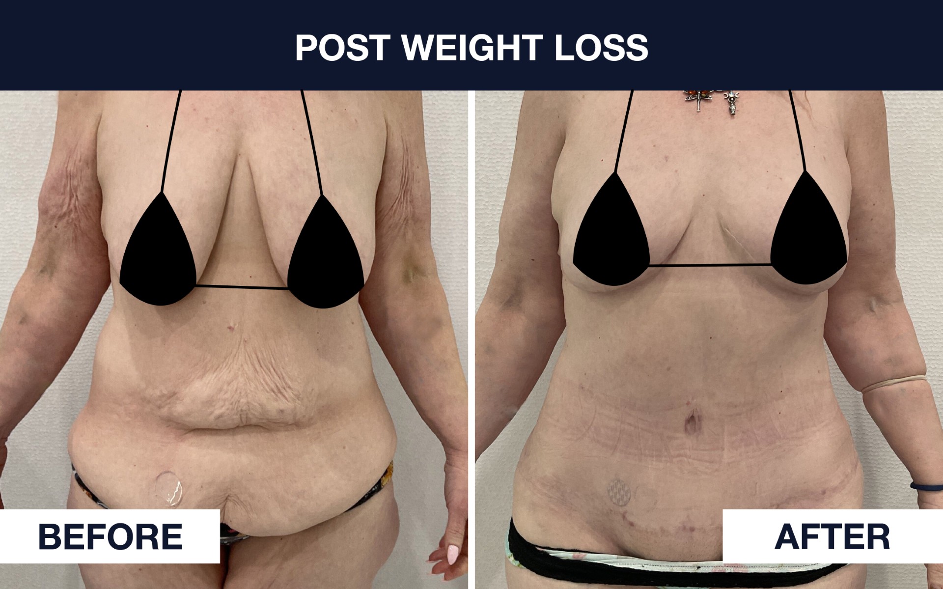 Before & After Photo
