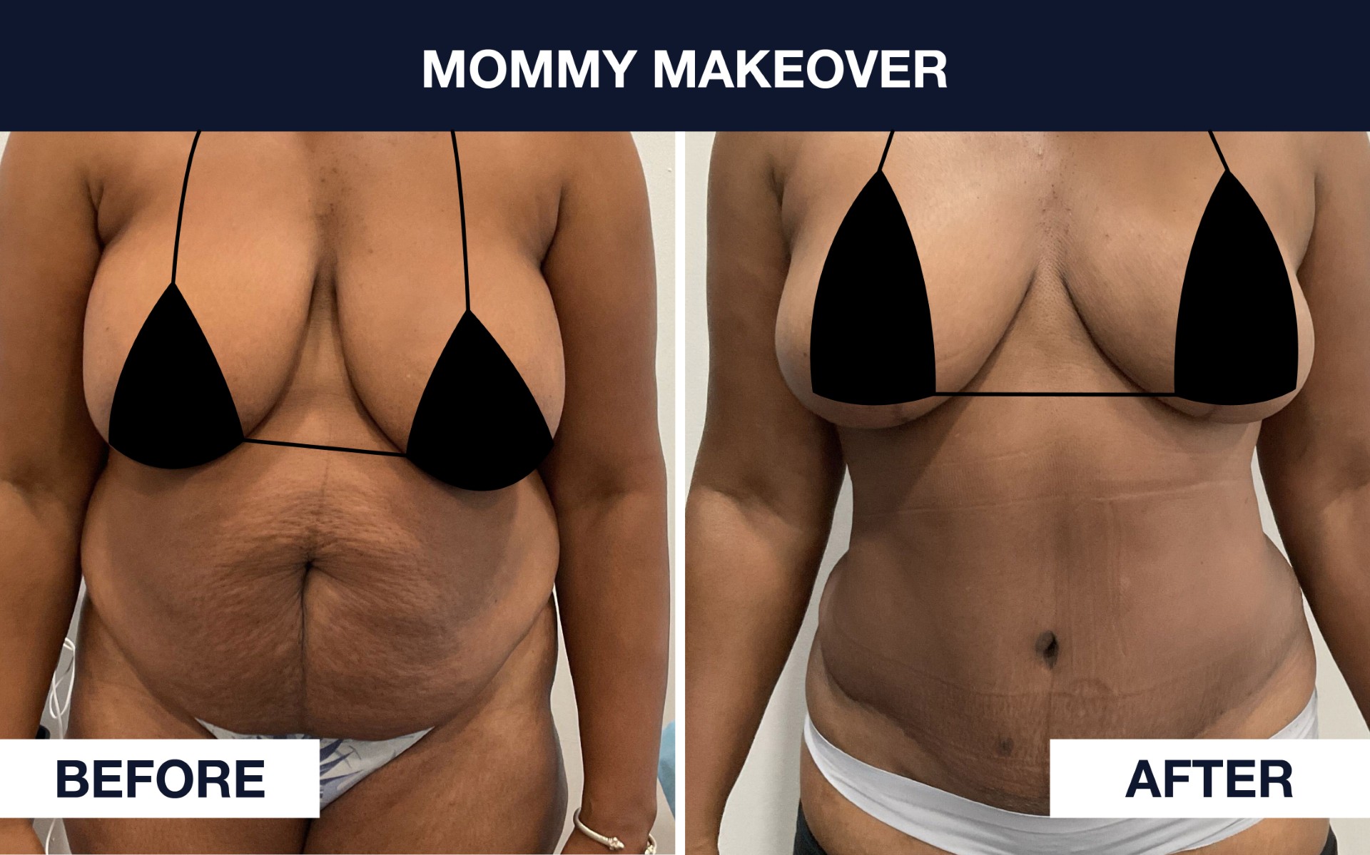 Before & After Photo