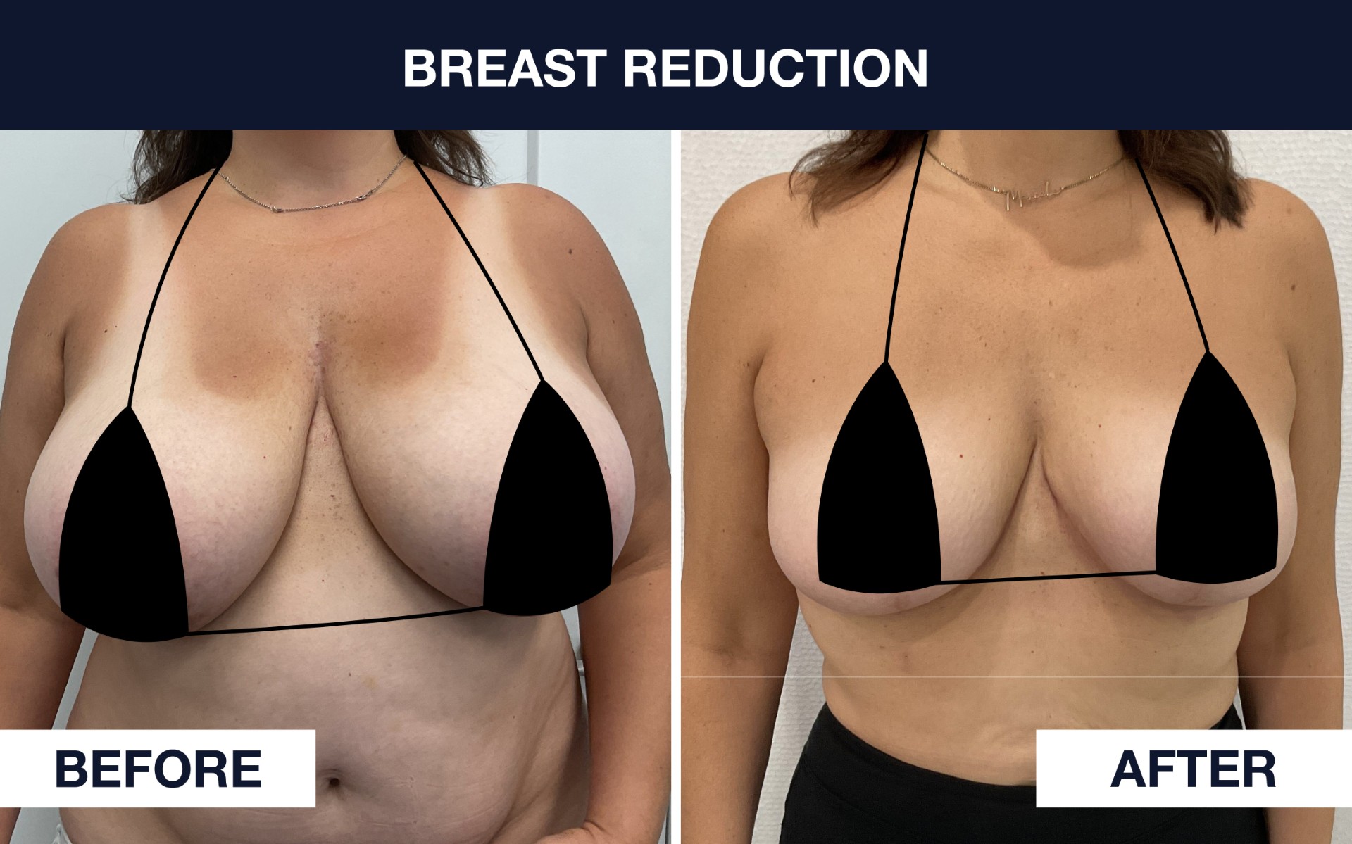 Before & After Photo