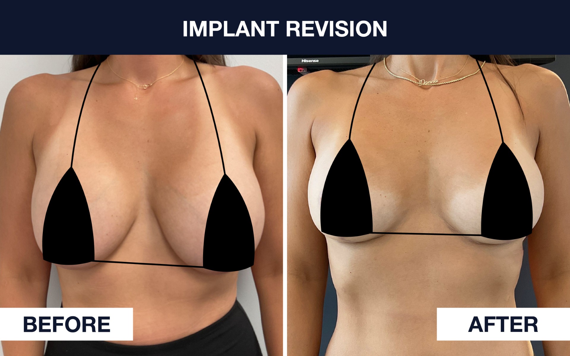Before & After Photo